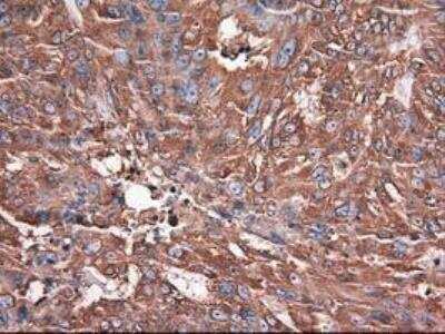 Immunohistochemistry-Paraffin: Carboxypeptidase A1/CPA1 Antibody (OTI2A3) [NBP1-47704]