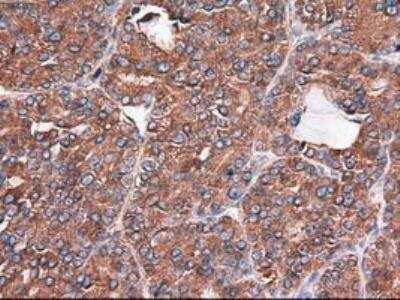 Immunohistochemistry-Paraffin: Carboxypeptidase A1/CPA1 Antibody (OTI2A3) [NBP1-47704]