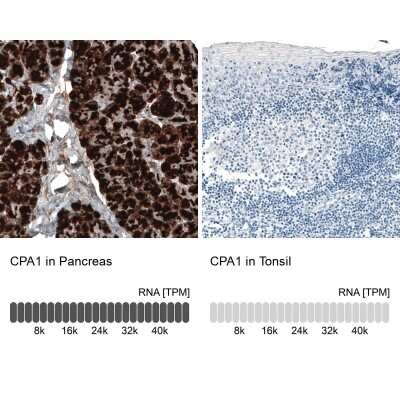 Immunohistochemistry-Paraffin: Carboxypeptidase A1/CPA1 Antibody (CL6607) [NBP2-76507]