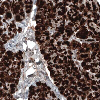 Immunohistochemistry-Paraffin: Carboxypeptidase A1/CPA1 Antibody (CL6607) [NBP2-76507]