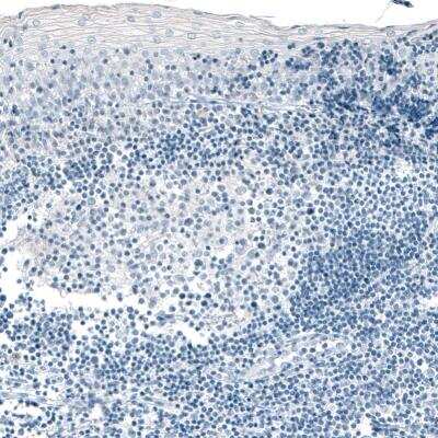 Immunohistochemistry-Paraffin: Carboxypeptidase A1/CPA1 Antibody (CL6607) [NBP2-76507]