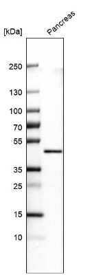 Western Blot: Carboxypeptidase A1/CPA1 Antibody (CL6607) [NBP2-76507]