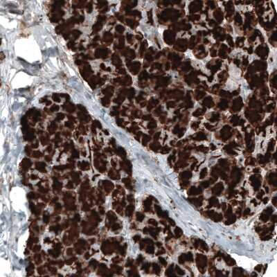 Immunohistochemistry-Paraffin: Carboxypeptidase A1/CPA1 Antibody (CL6629) [NBP2-76509]
