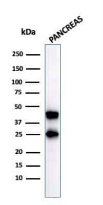 Western Blot: Carboxypeptidase A1/CPA1 Antibody (CPA1/2712)Azide and BSA Free [NBP2-79880]