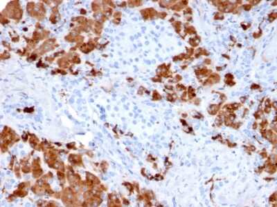 Immunohistochemistry-Paraffin: Carboxypeptidase A1/CPA1 Antibody (CPA1/2712) [NBP2-79745]