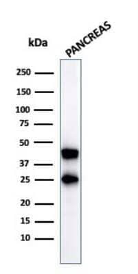 Western Blot: Carboxypeptidase A1/CPA1 Antibody (CPA1/2712) [NBP2-79745]