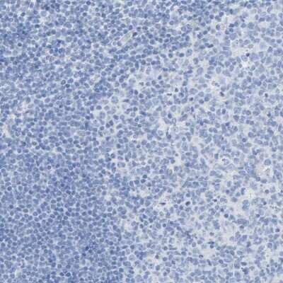 Immunohistochemistry-Paraffin: Carboxypeptidase A1/CPA1 Antibody [NBP1-88056]