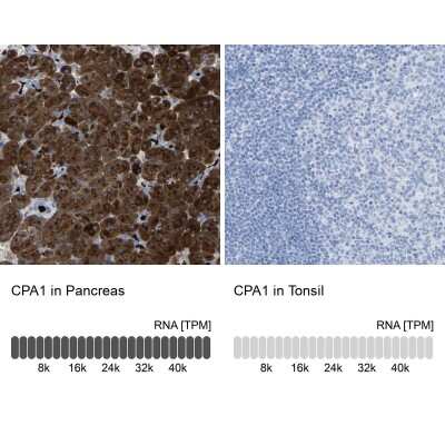 Immunohistochemistry-Paraffin: Carboxypeptidase A1/CPA1 Antibody [NBP1-88056]