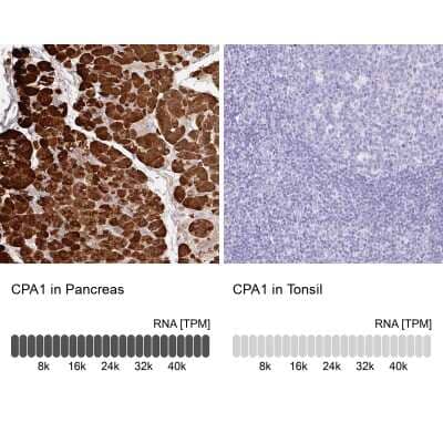 Immunohistochemistry-Paraffin: Carboxypeptidase A1/CPA1 Antibody [NBP2-33640]