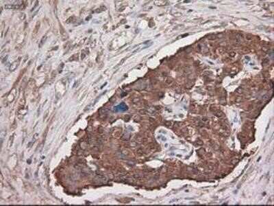 Immunohistochemistry: Carboxypeptidase A1/CPA1 Antibody (OTI2A3) - Azide and BSA Free [NBP2-70431]