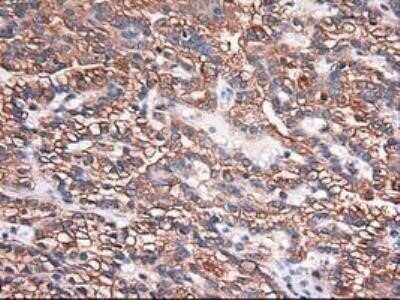 Immunohistochemistry: Carboxypeptidase A1/CPA1 Antibody (OTI2A3) - Azide and BSA Free [NBP2-70431]