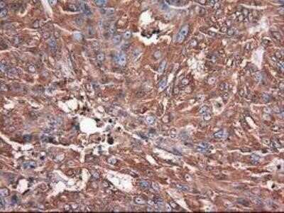 Immunohistochemistry: Carboxypeptidase A1/CPA1 Antibody (OTI2A3) - Azide and BSA Free [NBP2-70431]