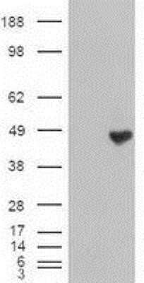 Western Blot: Carboxypeptidase A1/CPA1 Antibody (OTI2A3)Azide and BSA Free [NBP2-70431]