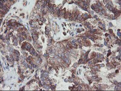 Immunohistochemistry-Paraffin: Carboxypeptidase A2/CPA2 Antibody (OTI1C7) [NBP2-01992]