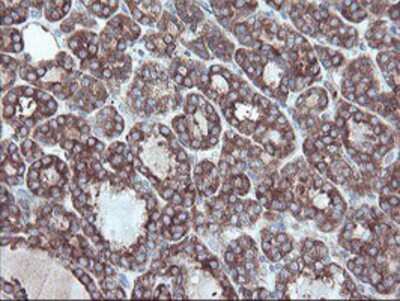 Immunohistochemistry-Paraffin: Carboxypeptidase A2/CPA2 Antibody (OTI1C7) [NBP2-01992]