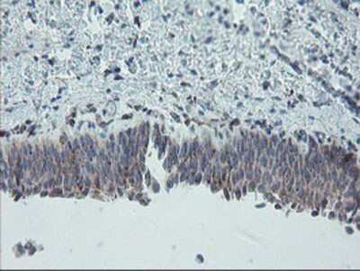 Immunohistochemistry-Paraffin: Carboxypeptidase A2/CPA2 Antibody (OTI1C7) [NBP2-01992]