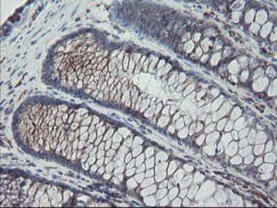 Immunohistochemistry-Paraffin: Carboxypeptidase A2/CPA2 Antibody (OTI1C7) [NBP2-01992]
