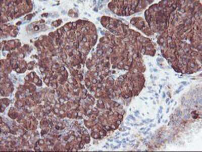 Immunohistochemistry-Paraffin: Carboxypeptidase A2/CPA2 Antibody (OTI1C7) [NBP2-01992]