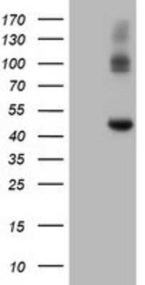 Western Blot: Carboxypeptidase A2/CPA2 Antibody (OTI1C7) [NBP2-01992]