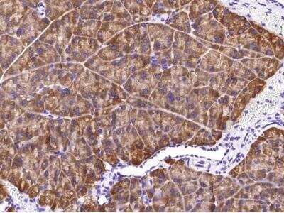 Immunohistochemistry-Paraffin: Carboxypeptidase A2/CPA2 Antibody (133) [NBP2-90716]