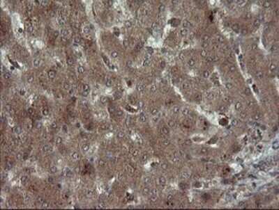 Immunohistochemistry: Carboxypeptidase A2/CPA2 Antibody (OTI3D8) [NBP2-46344]