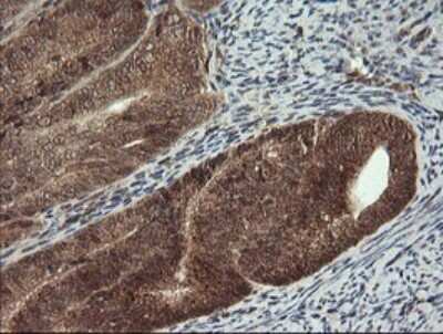 Immunohistochemistry: Carboxypeptidase A2/CPA2 Antibody (OTI3D8) [NBP2-46344]