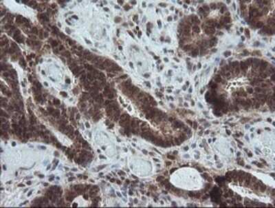 Immunohistochemistry: Carboxypeptidase A2/CPA2 Antibody (OTI3D8) [NBP2-46344]
