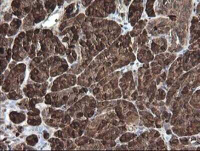Immunohistochemistry: Carboxypeptidase A2/CPA2 Antibody (OTI3D8) [NBP2-46344]