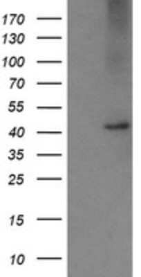 Western Blot: Carboxypeptidase A2/CPA2 Antibody (OTI3D8) [NBP2-46344]