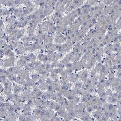 Immunohistochemistry-Paraffin: Carboxypeptidase A2/CPA2 Antibody [NBP1-86028]