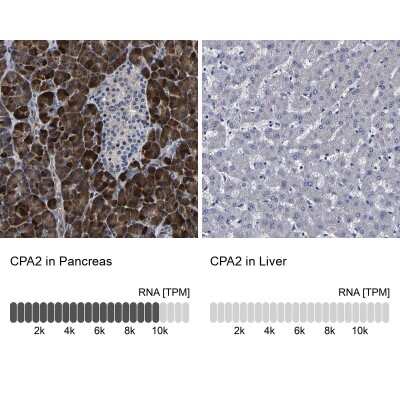 Immunohistochemistry-Paraffin: Carboxypeptidase A2/CPA2 Antibody [NBP1-86028]