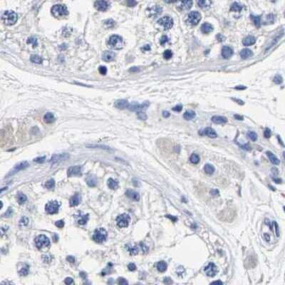 Immunohistochemistry-Paraffin: Carboxypeptidase A2/CPA2 Antibody [NBP1-86028]