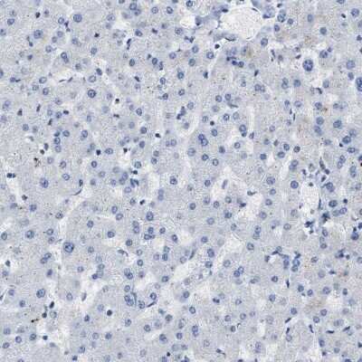 Immunohistochemistry-Paraffin: Carboxypeptidase A2/CPA2 Antibody [NBP1-87555]