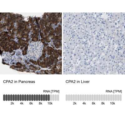 Immunohistochemistry-Paraffin: Carboxypeptidase A2/CPA2 Antibody [NBP1-87555]