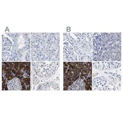 Immunohistochemistry-Paraffin: Carboxypeptidase A2/CPA2 Antibody [NBP1-87555]