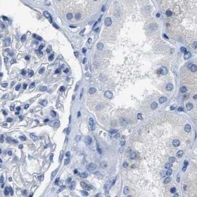 Immunohistochemistry-Paraffin: Carboxypeptidase A2/CPA2 Antibody [NBP1-87555]