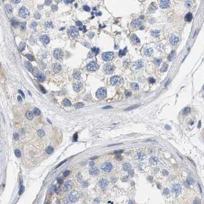 Immunohistochemistry-Paraffin: Carboxypeptidase A2/CPA2 Antibody [NBP1-87555]