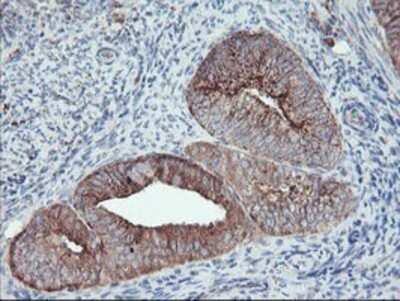 Immunohistochemistry: Carboxypeptidase A2/CPA2 Antibody (OTI1C7) - Azide and BSA Free [NBP2-70440]