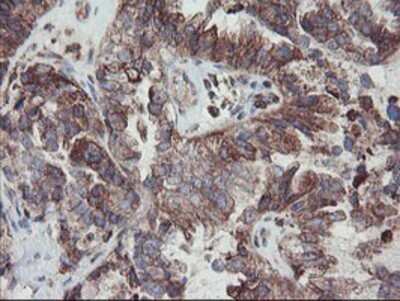 Immunohistochemistry: Carboxypeptidase A2/CPA2 Antibody (OTI1C7) - Azide and BSA Free [NBP2-70440]