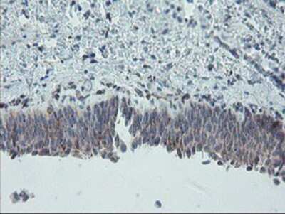 Immunohistochemistry: Carboxypeptidase A2/CPA2 Antibody (OTI1C7) - Azide and BSA Free [NBP2-70440]