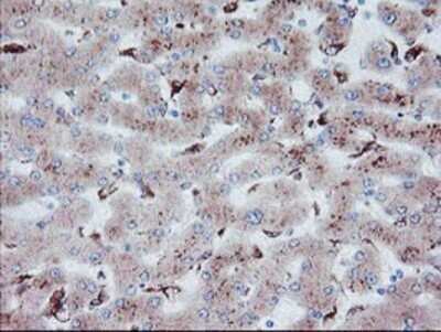 Immunohistochemistry: Carboxypeptidase A2/CPA2 Antibody (OTI1C7) - Azide and BSA Free [NBP2-70440]