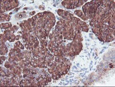 Immunohistochemistry: Carboxypeptidase A2/CPA2 Antibody (OTI1C7) - Azide and BSA Free [NBP2-70440]