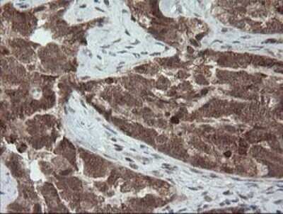 Immunohistochemistry: Carboxypeptidase A2/CPA2 Antibody (OTI3D8) - Azide and BSA Free [NBP2-70443]