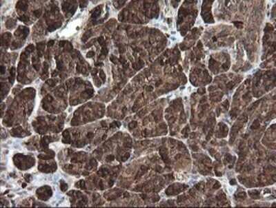 Immunohistochemistry: Carboxypeptidase A2/CPA2 Antibody (OTI3D8) - Azide and BSA Free [NBP2-70443]