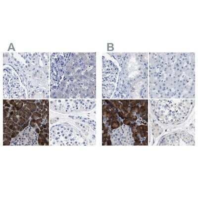 Western Blot: Carboxypeptidase A2/CPA2 Antibody [NBP1-86028]