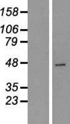 Western Blot: Carboxypeptidase A2/CPA2 Overexpression Lysate [NBP2-10775]