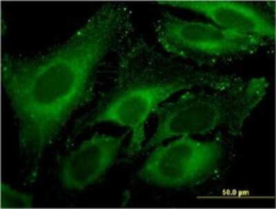 Immunocytochemistry/ Immunofluorescence: Carboxypeptidase A4/CPA4 Antibody (1F4) [H00051200-M07]