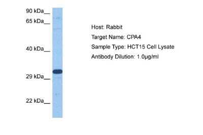 Western Blot: Carboxypeptidase A4/CPA4 Antibody [NBP2-84589]