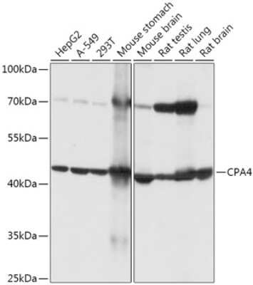 Western Blot: Carboxypeptidase A4/CPA4 AntibodyAzide and BSA Free [NBP2-92372]