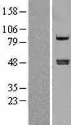 Western Blot: Carboxypeptidase A4/CPA4 Overexpression Lysate [NBL1-09426]